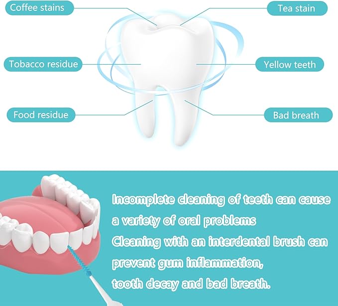 250 Pieces Dental Floss Picks, Silicone Interdental Brushes with Case Dental Brushes Dental Picks Green Tooth Floss Picks for Teeth Cleaning(Green)