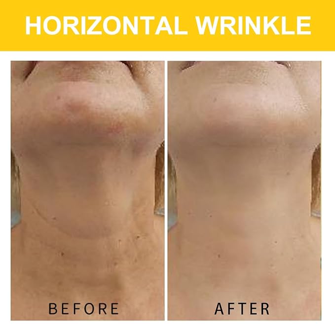 Neck Cream, Neck Creams for Tightening and Firming, Wrinkle Cream for Women, Skin Tightening Cream for Face, Neck, Chest & Décolleté.