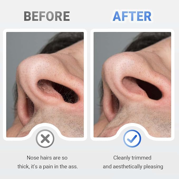 Drkicsy Rechargeable Portable Nose Hair Trimmer for Men and Women, Electric Nose Hair Remover Nasal Hair Cutter Shaver (Black)