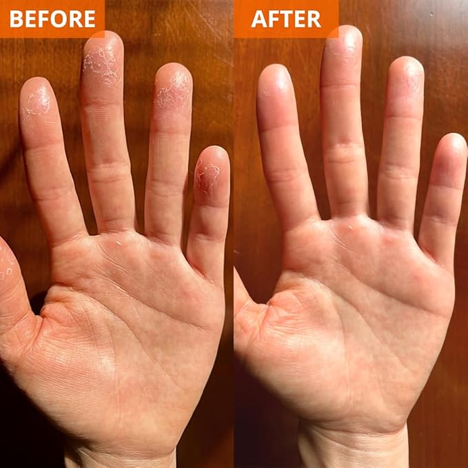 Yu-Be Advanced Formula Pure Hydration Cream Samples (20 Pack) – Fragrance-Free Hand & Body Moisturizer for Dry, Sensitive-Prone Skin – Glycerin-Rich, Travel Size (0.10 fl oz Each)