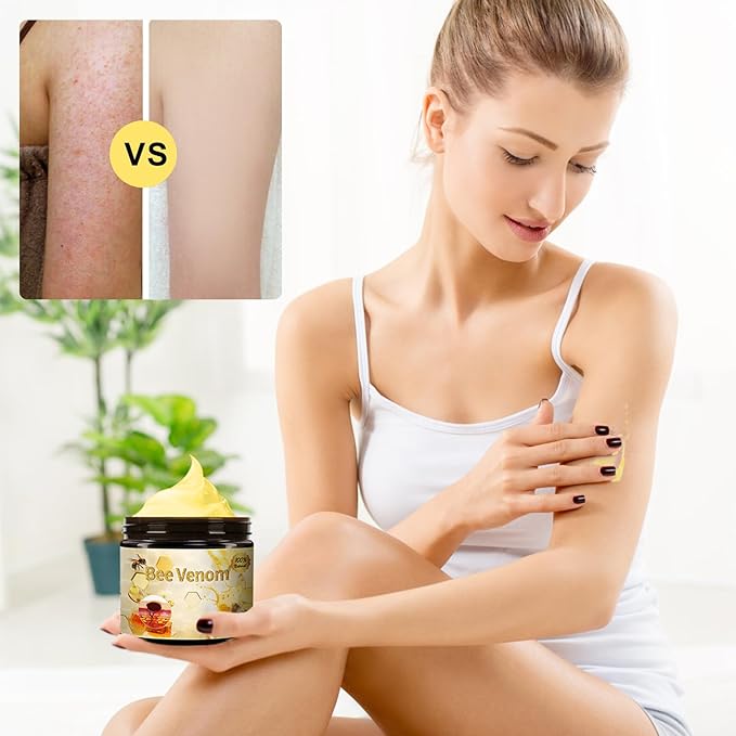 2pcs Bee Venom Treatment, New Professional Bee Venom Repair Cream, Bee Venom Cream for All Body Parts