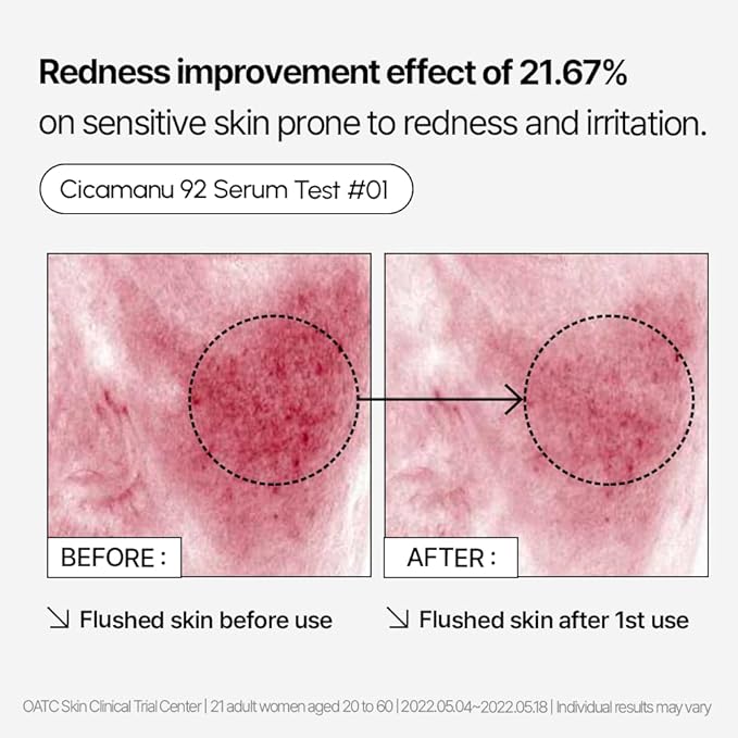 Parnell Cicamanu 92 Serum (1.01 Fl Oz) 30ml | Melatonin, Centella Asiatica | Ceramide for Overnight Recovery & Soothing Irritated Skin | Targets Hyperpigmentation & Deep Hydration | Korean Skin Care