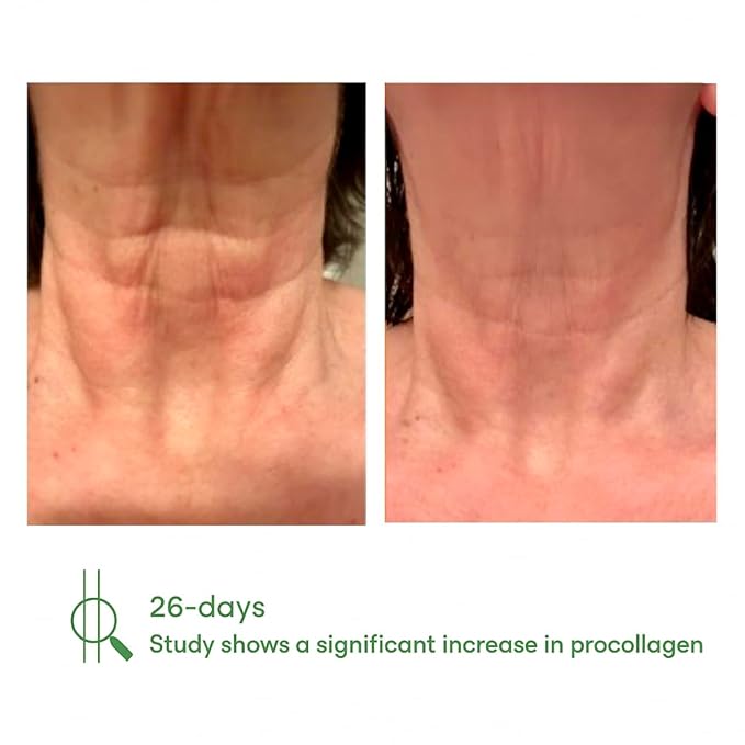 NECK+ Regenerative Cream, Collagen Boosting Neck Cream, Firms,Tightens, Lifts, with Peptides & Growth Factor Complex, Gentle, Clinically Tested, 0.5 fl oz (Travel Size + Applicator Bundle)