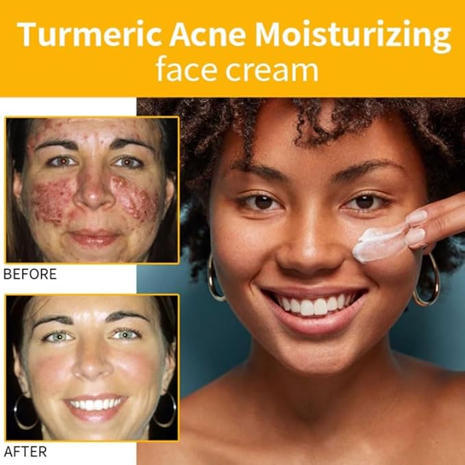 Turmeric Face Cream with Niacinamide Hyaluronic Acid Vitamin C and Jojoba Oil Brightening Moisturizing Anti Wrinkle Cream for Acne Spots Repair and Firm Skin (4)