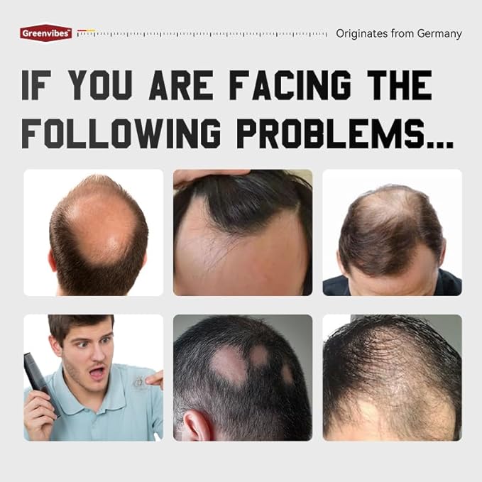 Hair Growth Spray, Hair Density Spray for Women & Men, Anti-Thinning Treatment for Thicker Fuller Hair, with Polyamino Sugar Condensate & Ginseng, Natural Hair Regrowth Serum for All Hair Types