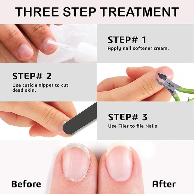 Professional Cuticle Trimmer Nail Cuticle Cutter Stainless Steel Cuticle Nippers with Sharp Blades of Cuticle Remover Clippers Manicure Tools Double Spring - Pedicure Nail Tools (Multi Color - 4 Pack)