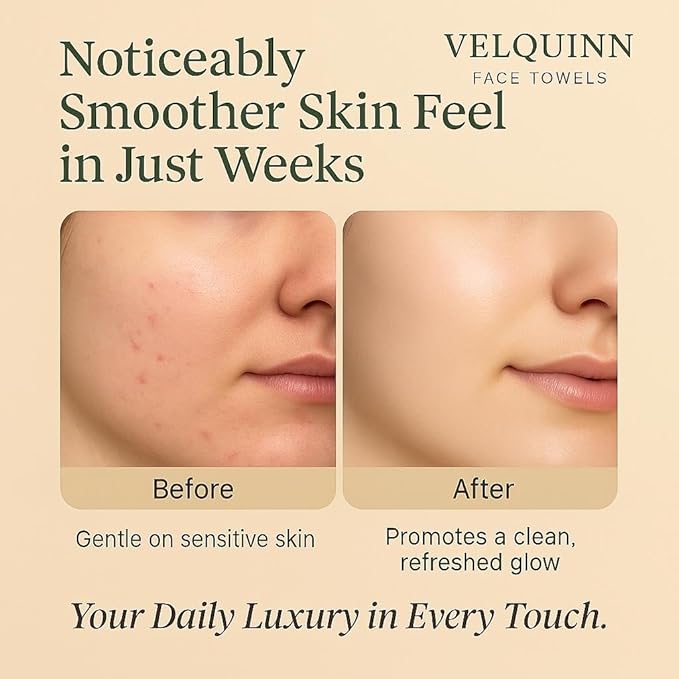 Velquinn Ultra Soft Face Towels, 100% Organic, Biodegradable, Hypoallergenic, Dermatologist Tested | 50 Count Pack for Daily Gentle Cleansing Pure - Eco-Luxurious Skincare You Can Trust