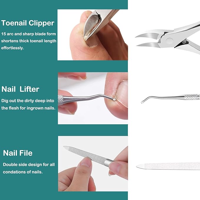 Pedicure Tools for Feet,Ingrown Toenail Treatment,Ingrown Toenail Removal Kit,Pedicure Set,Toenail Grooming Kit,Top Notch Foot Blade, Super Sharp Toenail Clippers (8 Pack)