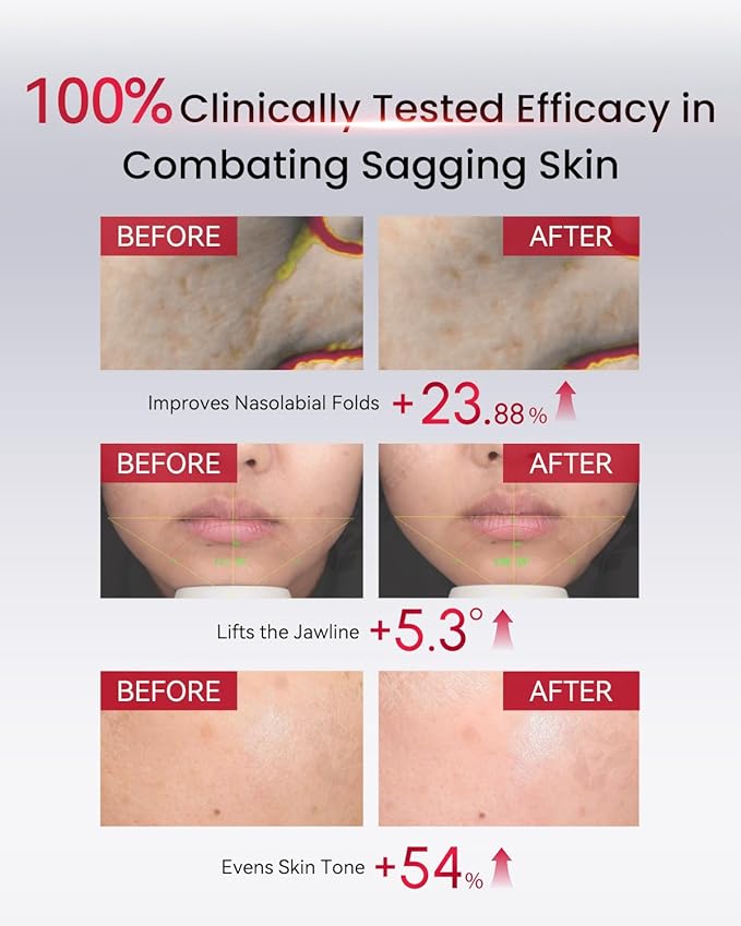 AMIRO HydraGlow Booster Facial Device, Red Light & Microcurrent + PDRN Serum Kit, Skin Firming & Radiance Enhancing, 1 Facial Massager & 30 * 0.04OZ PDRN Serum