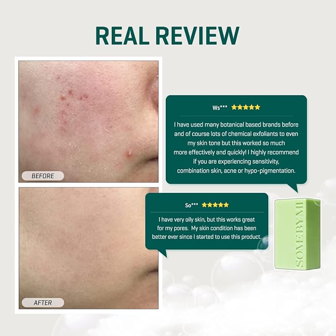 SOME BY MI AHA BHA PHA 30 Days Miracle Cleansing Bar – 3.73oz, 106g – Daily Exfoliating Tea Tree Body Soap Bar with Salicylic Acid for Back Acne – Deep Cleanses Sebum and Impurities – Korean Skin Care