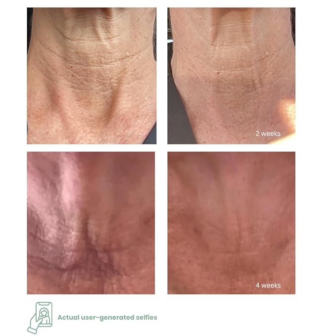 NECK+ Regenerative Cream, Collagen Boosting Neck Cream, Firms,Tightens, Lifts, with Peptides & Growth Factor Complex, Gentle on Skin,Clinically Tested, 1.7 fl oz (Full-Size)