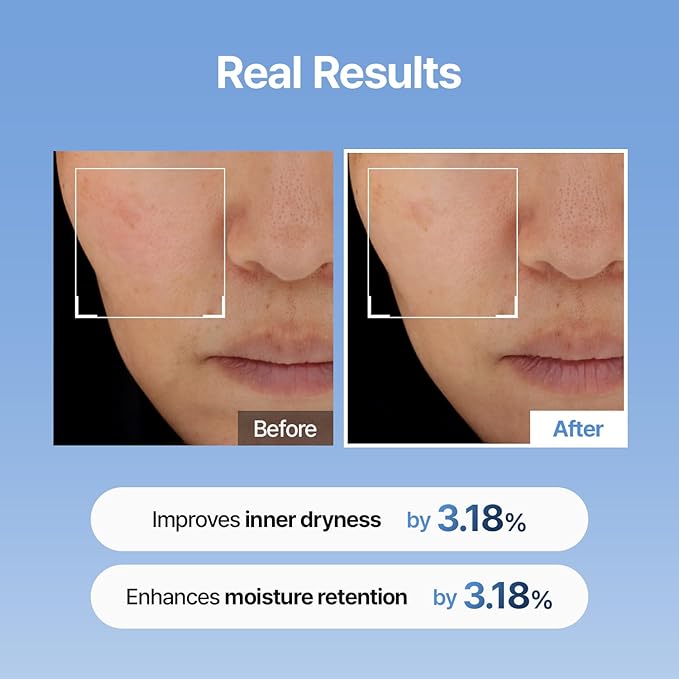 Meditherapy Hyaluronic Acid Serum XXL 150ml (5.07 fl.oz.) – Ultra Hydrating Serum for Glowing Skin, Non-Sticky, Anti-Aging & Wrinkle Care, Korean Skin Care