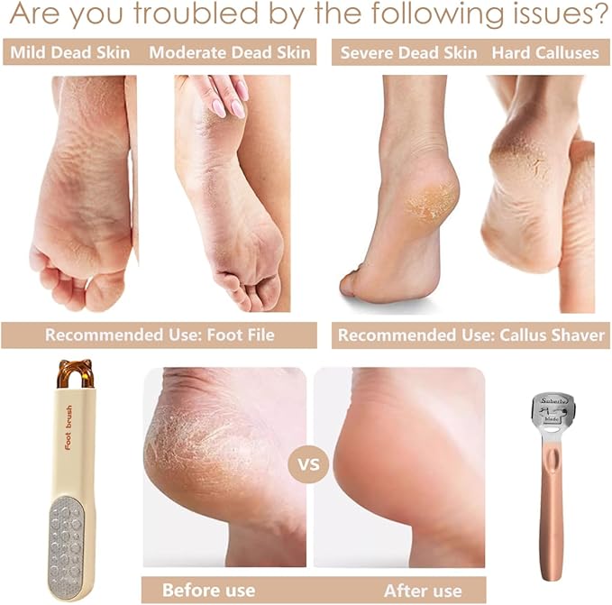 Dual-Sided Foot File-Dead Skin and Callus Shaver with 20 Blades-Stainless Steel Foot Remover for Removing Calluses, Aged Keratin, Hard Dead Skin, and Toe Gap Cleaning-Heel Scraper Pedicure Tool Kit