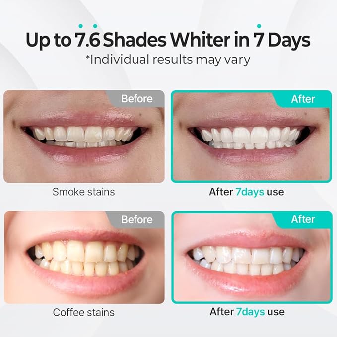 Puredia Whitening Toothpaste 80g – Fluoride-Free, Nano Hydroxyapatite & Hydrogen Peroxide, Sensitive Teeth, Enamel Strengthening, Natural Mint Gel