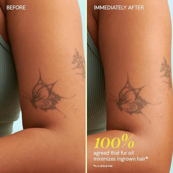 Fur Oil - Prevent Ingrown Hairs - Moisturize and Soften Dry Skin - 2.5fl oz with Ingrown Eliminator Mitt