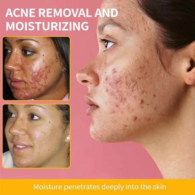 Turmeric Face Cream with Niacinamide Hyaluronic Acid Vitamin C and Jojoba Oil Brightening Moisturizing Anti Wrinkle Cream for Acne Spots Repair and Firm Skin (1)