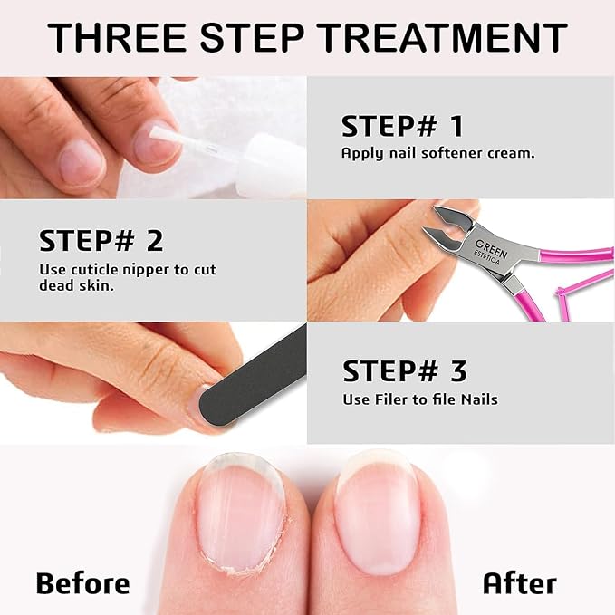 Professional Cuticle Trimmer Nail Cuticle Cutter Stainless Steel Cuticle Nippers with Sharp Blades of Cuticle Remover Clippers Manicure Tools Double Spring - Pedicure Nail Tools (Pink - 4 Pack)