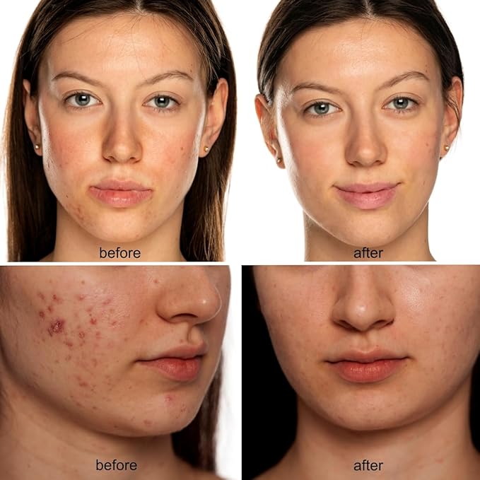 Beauty LED mask – Red Light & Infrared Light Therapy Face Mask for Wrinkles – Blue Light for Acne – Multi-wavelength for Skincare – Rechargeable for Home Use and Travel