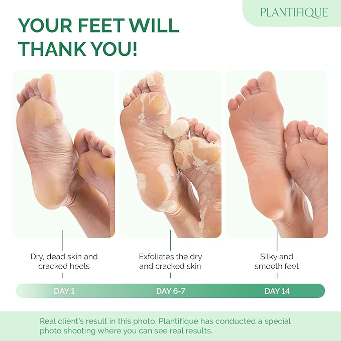 PLANTIFIQUE Foot Peeling Mask 2 Pack | Dermatologically Tested Repairs Heels & Removes Dry Dead Skin for Baby Soft Feet | Exfoliating Foot Peel Mask for Dry Cracked Feet | Jasmine