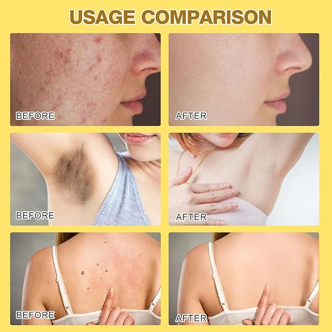 2pcs Bee Venom Treatment, New Professional Bee Venom Repair Cream, Bee Venom Cream for All Body Parts