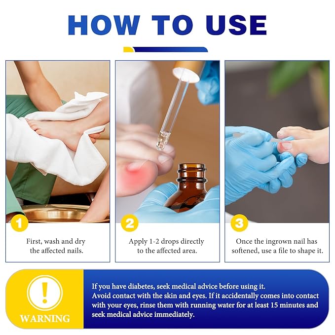 Nail Removal Kit,Toenail Drops,Softens Nails,Nail Care Tool Set,Ingrown Toenail Corrector,Corrector Patch,Nail File,60ml