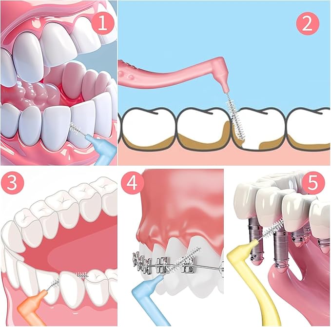50pcs Interdental Brushes, 5 Sizes Braces Brush Set Soft Dental Brushes with Non-Slip Handle Angled Head Tooth Picks Floss Sticks Dental Floss Brushes for Braces Oral Cleaning