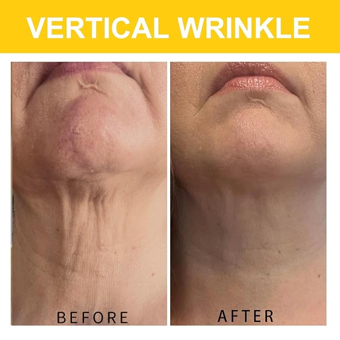 Neck Cream, Neck Creams for Tightening and Firming, Wrinkle Cream for Women, Skin Tightening Cream for Face, Neck, Chest & Décolleté.