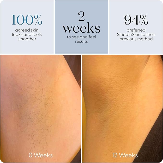 SmoothSkin Pure Adapt Champagne IPL Hair Removal Device, at-Home Laser Hair Removal for Women & Men, Visible Results in 2 Weeks, Safe for Face & Body, Long-Lasting Hair Reduction, Full Body Use