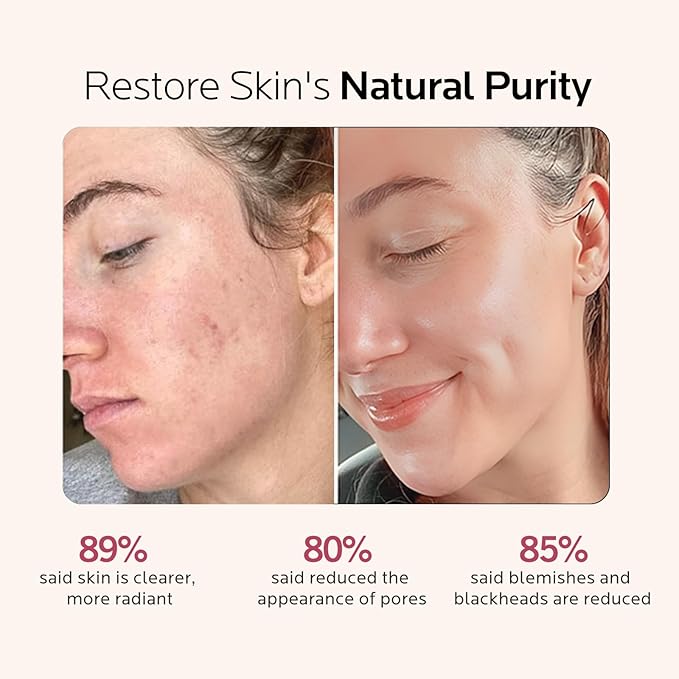 Facial Steamer Skin Care Kit: Face Steamer Home Spa Deep Cleaning Unclogs Pores - Humidifier Hot Mist Relaxing Self Care Gifts for Women with 17 Skin Care Tools