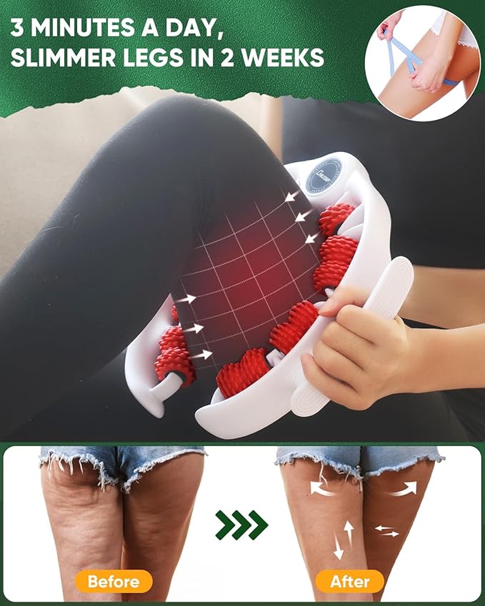 ONUEMP Cellulite Remover for Legs, Cellulite Massager Roller Muscle Roller, Fascia Massage Tool Thigh, Calf, Leg Massager - Anti-Celulitis, Lymphatic Drainage, Body Sculpting, Deep Tissue Pain Relief