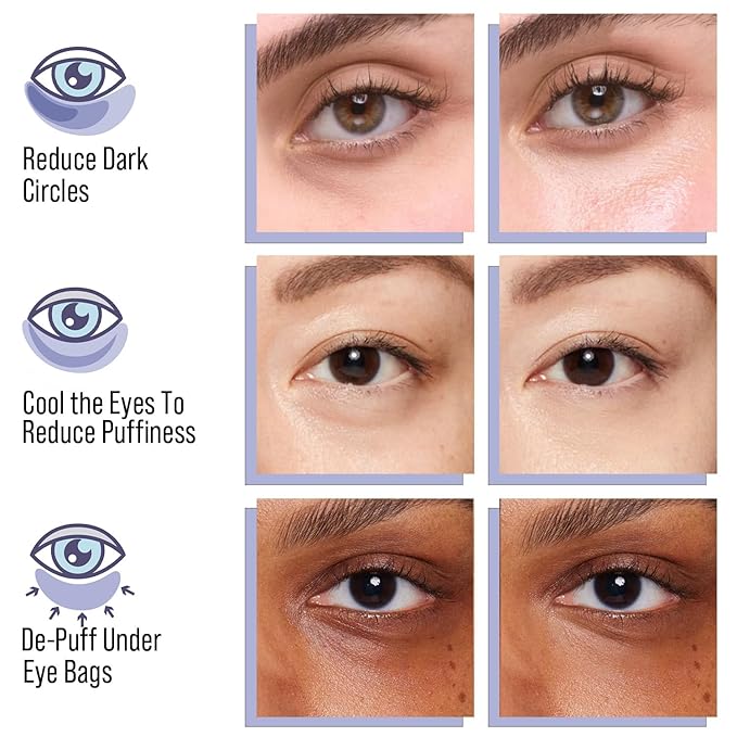 SIRIUSLY BRIGHT Under Eye Patches 28 Pairs, 5-Min Revitalizing Eye Masks with Caffeine Hyaluronic Acid Iris Moss to Reduce Dark Circles and Puffiness, Brightening & Depuffing Gifts for Women