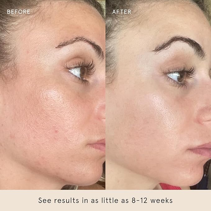 Barefaced Serum Trio - Liquid Gold, Overachiever, RetinAL - Powerful Ingredients for Healthier, Smoother Skin