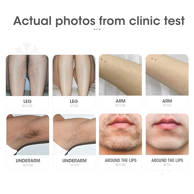 DEESS IPL Laser Hair Removal Device for Women & Men, GP591 3 in 1 Fastest Flashes ICE-Cooling Permanent Hair Remover, Safe & Painless, Long-lasting Reduction of Body & Face Hair Regrowth, Home Use