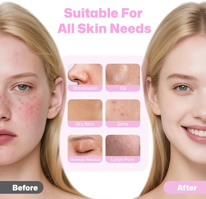 PRITECH Facial Cleansing Brush, Rechargeable Silicone Face Scrubber with Constant-Temperature Heating, Vibrating Exfoliator Scrubber for Deep Pore Cleaning, Waterproof Face Brush for Women & Men -Pink