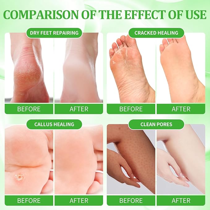 Pedicure Kit Foot Soak Set: Bubble Salt, Sugar Scrub, Massage Mask, Massage Lotion in a Box, 4 Step Foot Spa Kit for Dry Feet, Calluses and Tired Feet(3 Set Lemon)