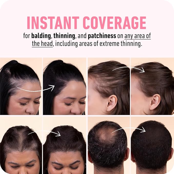 BOLDIFY Hairline Powder (LARGE, 10g) - Root Touch Up Hair Color for Gray Coverage - Bald Spot Concealing Hair Powder for Women & Men - 24-Hour Stain-Proof - Dark Brown