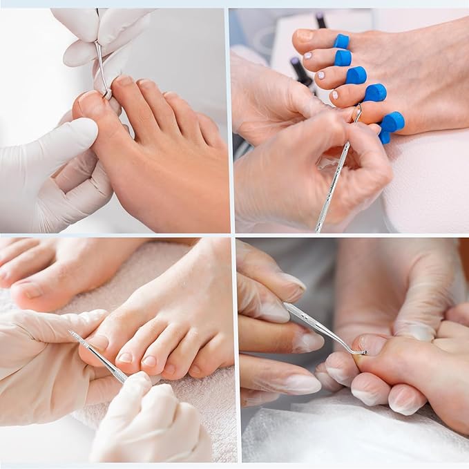 6PCS Ingrown Toenail File and Lifters, Professional Surgical Stainless Steel Ingrown Toenail Tool- Safe Nail Cleaning Treatment Pedicure Tools Kit Under Sidewall Cleaner Pain Relief Accessories