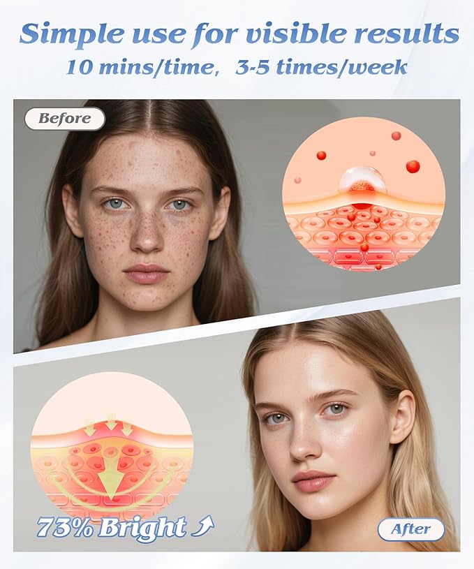 Red Light Photon Facial Mask, Wireless Rechargeable & Ergonomic Design with NIR, 850nm Infrared & Red Light Masks, Portable for Home & Travel