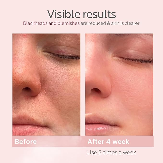 Colorfarm Facial Steamer Nano Ionic: Face Steamer Home Spa Kit Deep Cleaning Unclogs Pores Sinuses Inhaler with 8 Skin Care Tools - Self Care Gifts for Women (Deep Cleansing Facial Kit)