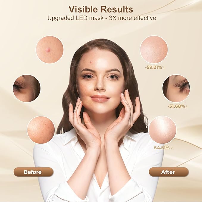 Red Light Therapy for Face, Led Face Mask Light Therapy with Rechargeable Remote, LED Face Mask Light Therapy at Home, Comfortable Red Light Therapy Mask