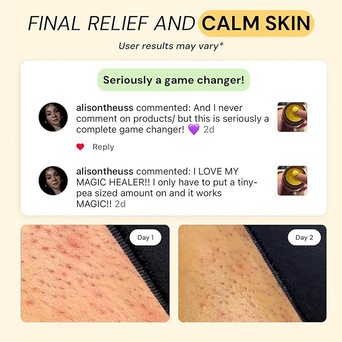 MyMagicHealer Thyme & Tea Tree Flare Care | Ingrown Hair, Razor Bumps, Blind Pimples, Bartholin, Pilonidal Cysts | Folliculitis Cure | Piercing Care w/Egg Yolk Extract & Tea Tree 1 oz