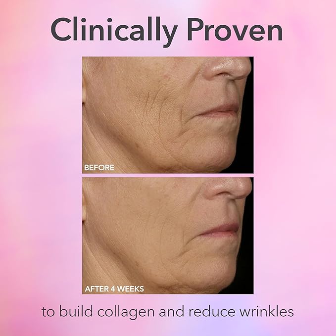 Dr. Dennis Gross DRx SpectraLite FaceWare Pro – LED Face Mask for Skin Rejuvenation with Dual Red & Blue Light Therapy