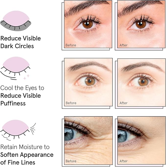 grace & stella Award Winning Under Eye Mask Reduce Dark Circles, Puffy Eyes, Undereye Bags, Wrinkles, Gel Under Eye Patches, Birthday Gifts for Women - Vegan - Thanksgiving Gifts (24 Pairs, Blue)