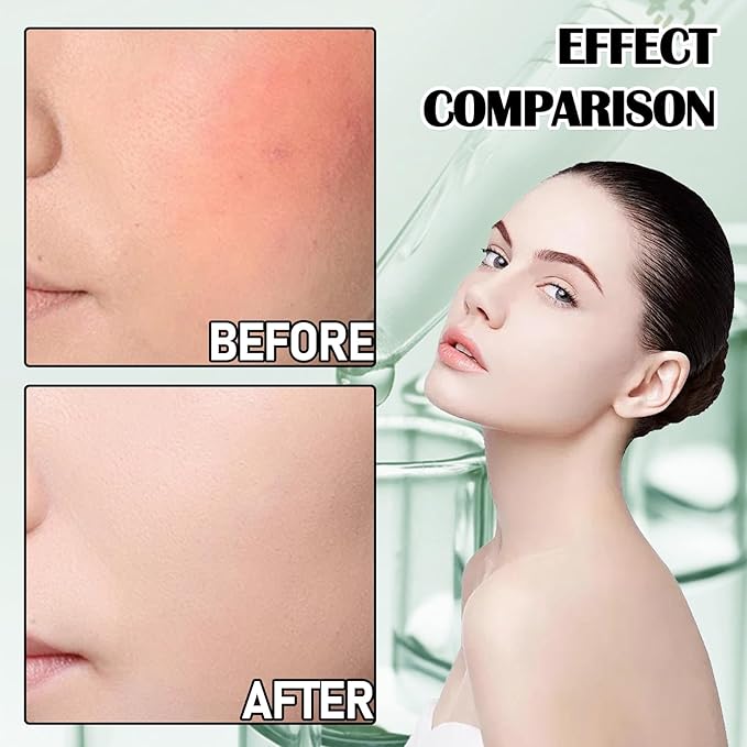 8Pcs Aloe Vera Gel for After Sun Skin Care