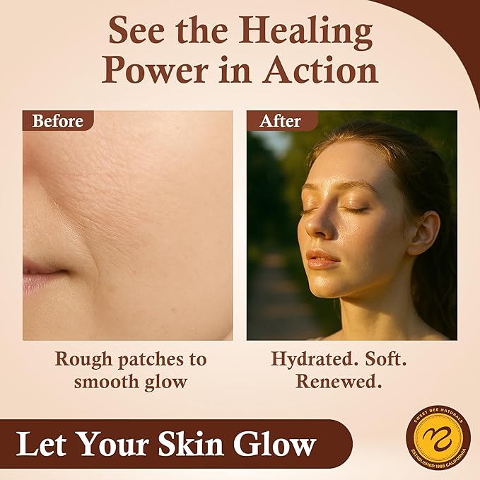 Sweet Bee Naturals - Sweet Bee Magic, All In One Healing Skin Cream. Organic Skin Balm, Small Batch Crafted in USA, 4 Ounce Jar. Certified Organic, 2-4 Ounce Jars (8 Ounce)