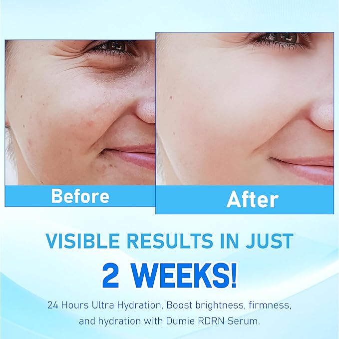 Salmon DNA PDRN Korean Collagen Hyaluronic Acid Ampoule, Anti-Aging Hydrating Serum with Glutathione, Niacinamide & 5000ppm Salmon Egg DNA, Firming Brightening Improves skin Radiance 0.05 fl.oz x 40e