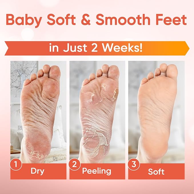 Foot Peel Mask - Foot Mask for Baby Soft Skin - Remove Dead Skin, Dry, Cracked Feet & Callus, Foot Spa, Made with Aloe Vera Extract for Women and Men (5 Pair (Pack of 1), Peach)
