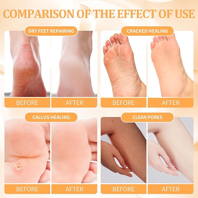 Pedicure Kit Foot Soak Set: Bubble Salt, Sugar Scrub, Massage Mask, Massage Lotion in a Box, 4 Step Foot Spa Kit for Dry Feet,Tired Feet（3 Set Tropical Fruit)