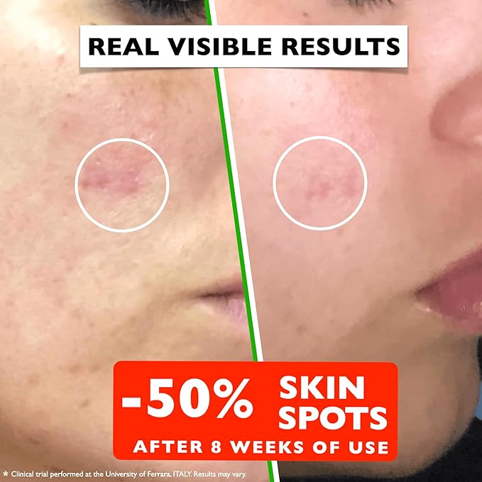 Vitamin C Serum For Face – Anti Aging Face Serum with Vitamin C, Hyaluronic Acid, Vitamin E. Brightening Formula. Improve Appearance of Dark Spots, Tone, Fine Lines & Wrinkles, Glowing Skin 2 Fl Oz