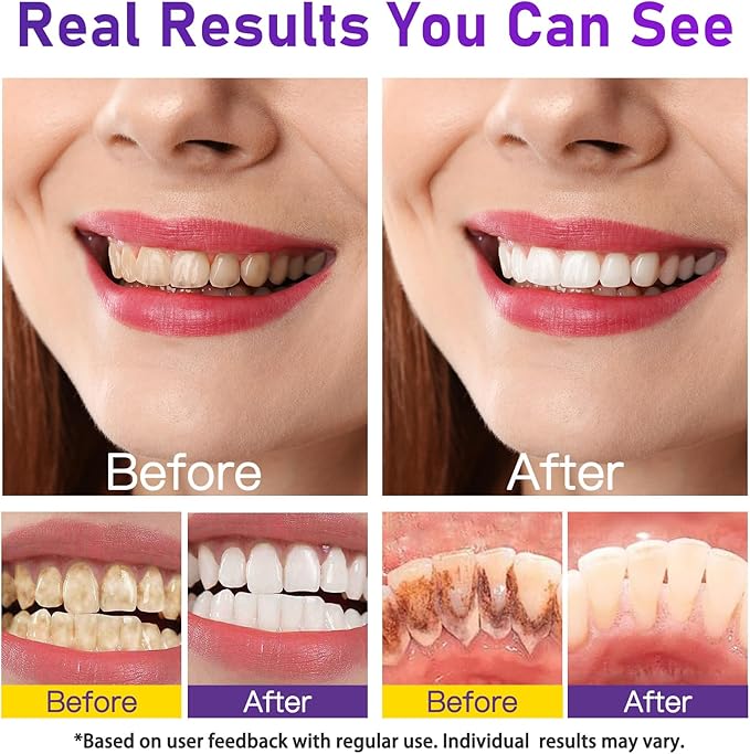 Teeth Whitening Powder - Teeth Whitening - Removes Stains - No Sensitivity - Enamel-Safe Toothpaste Power